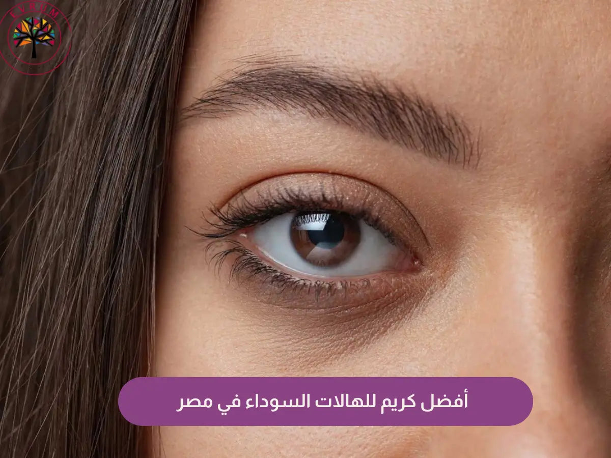 أفضل كريم للهالات السوداء في مصر