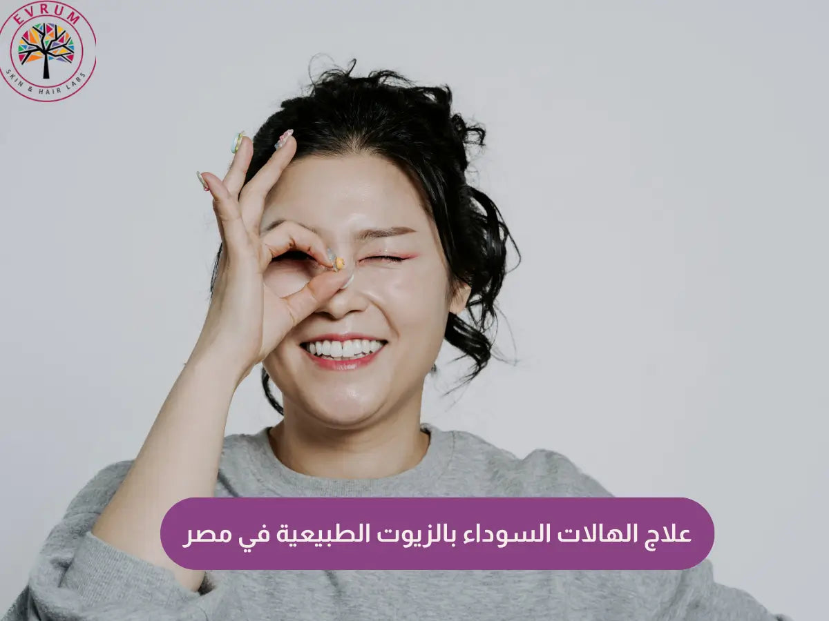 علاج الهالات السوداء بالزيوت الطبيعية