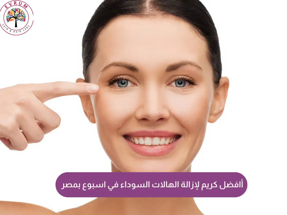 كريم لإزالة الهالات السوداء في اسبوع